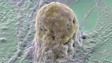 EU-domstolen slår i en dom fast att forskning som använder mänskliga embryon inte  kan patentsökas. 