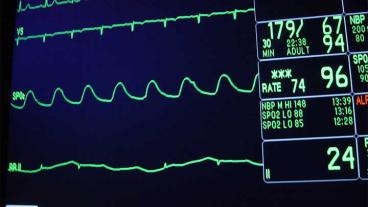 Patienters hemländer ska avgöra om sjukvård i andra länder ska betalas av det offentliga eller inte, skriver Henrik Hammar.